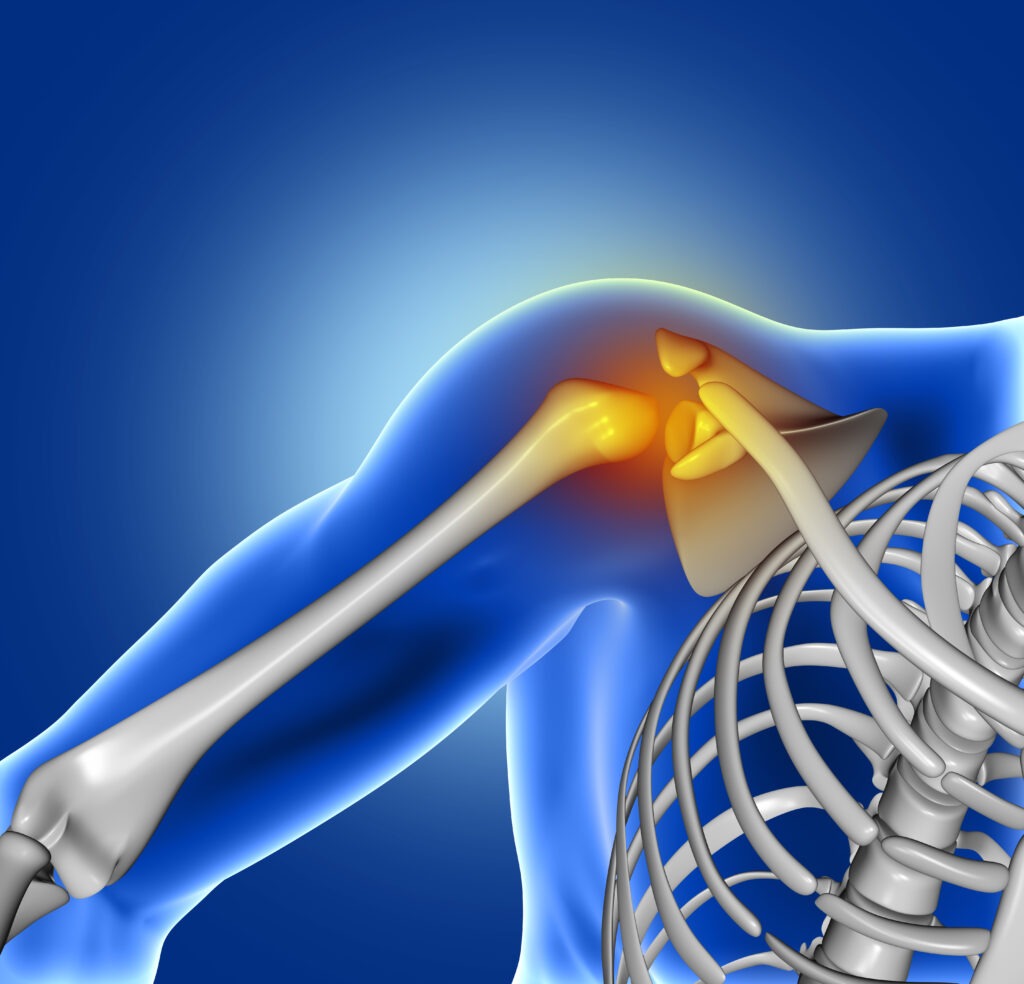 Orthopedic Vijayawada shoulder treatment
